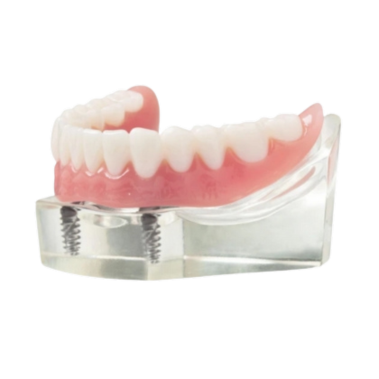 Transparent_Denture_Implant (1)